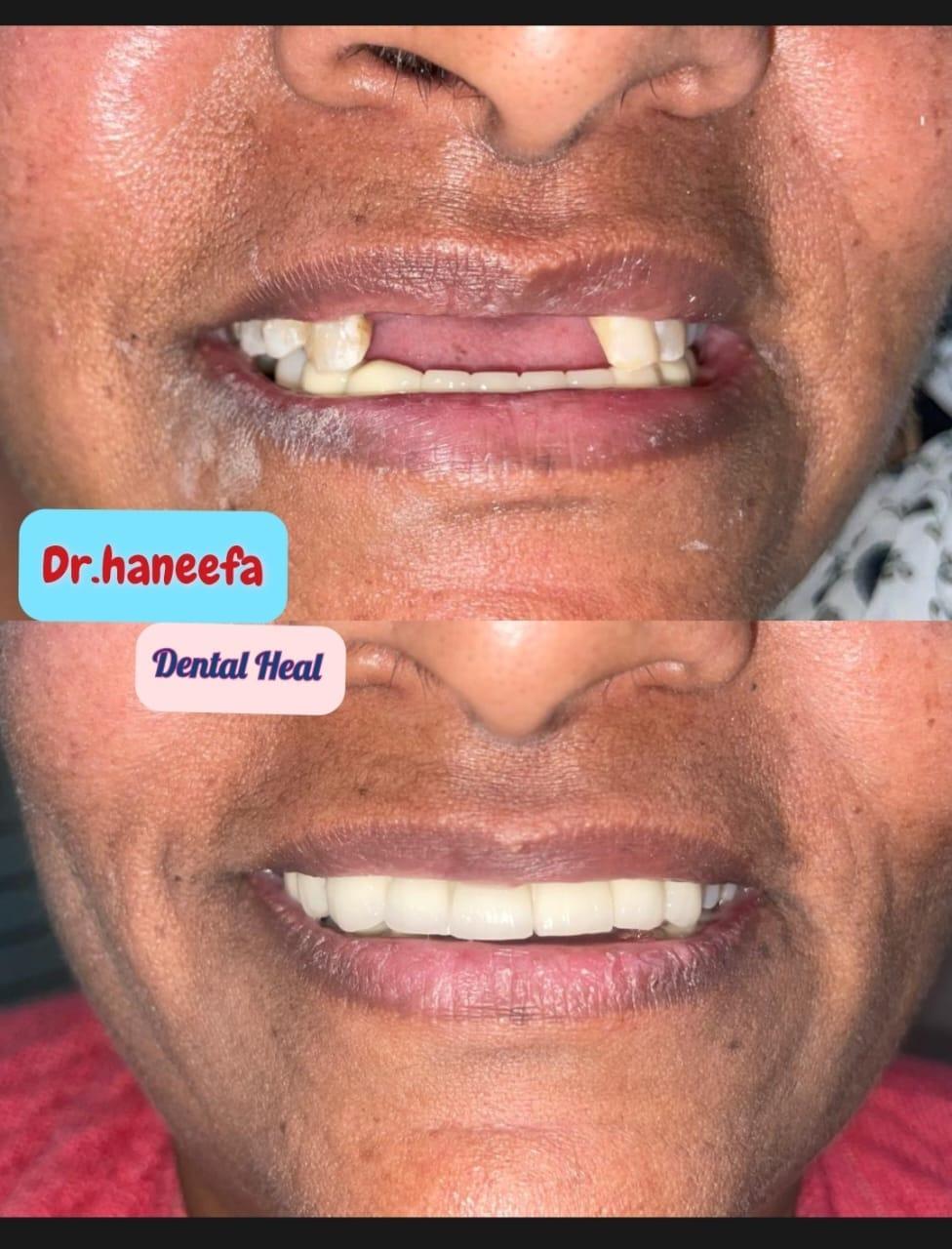 Dental transformation case 2