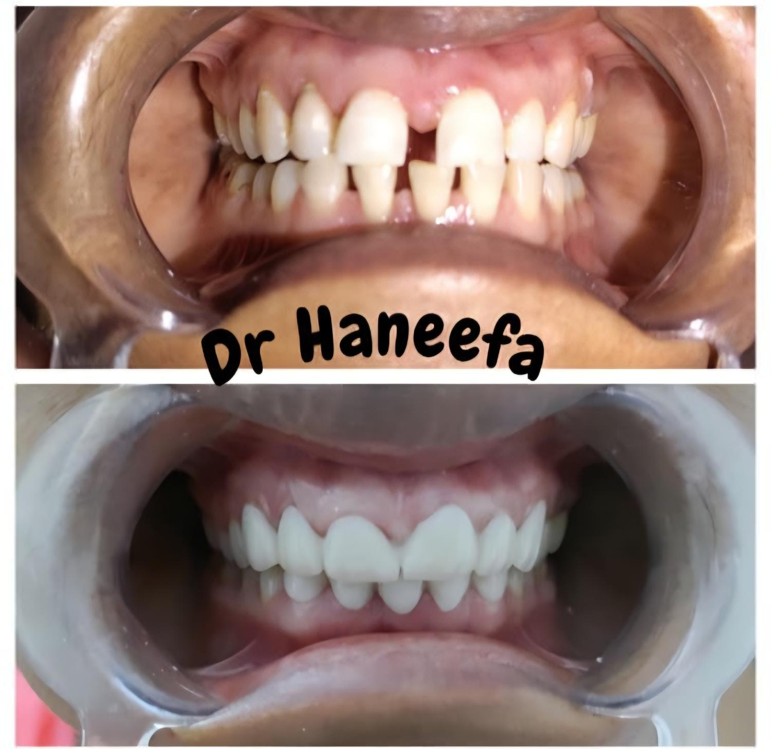 Dental transformation case 3