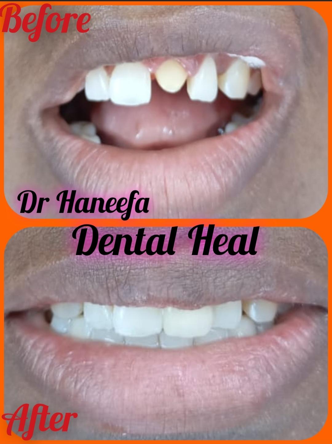 Dental transformation case 4