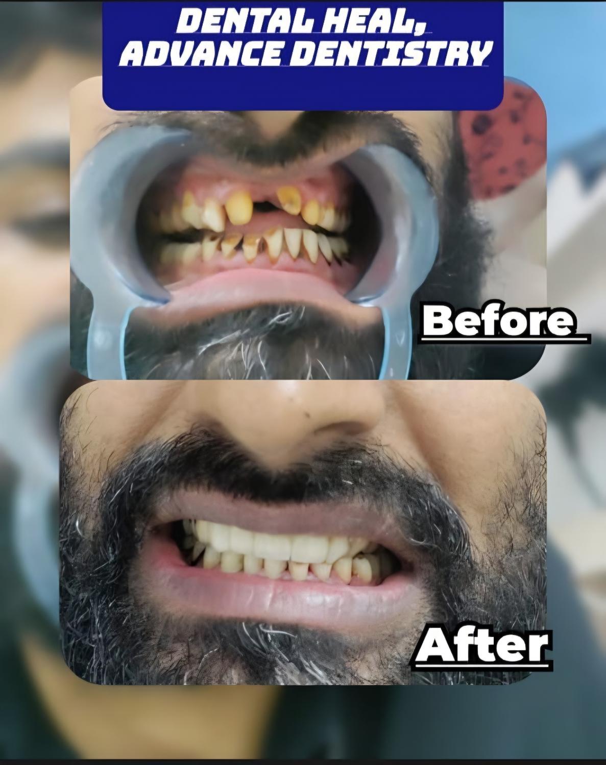 Dental transformation case 5