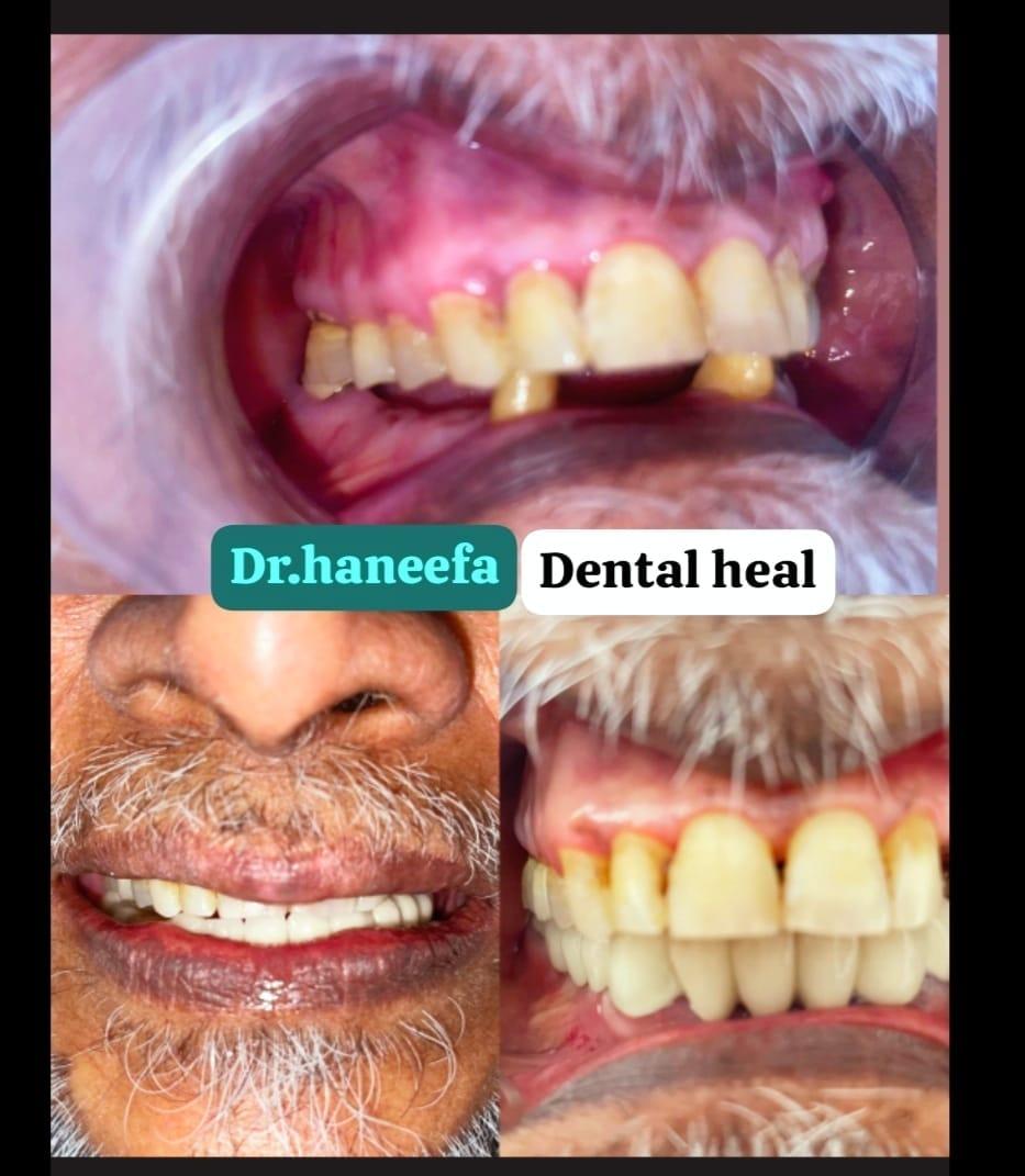Dental transformation case 7