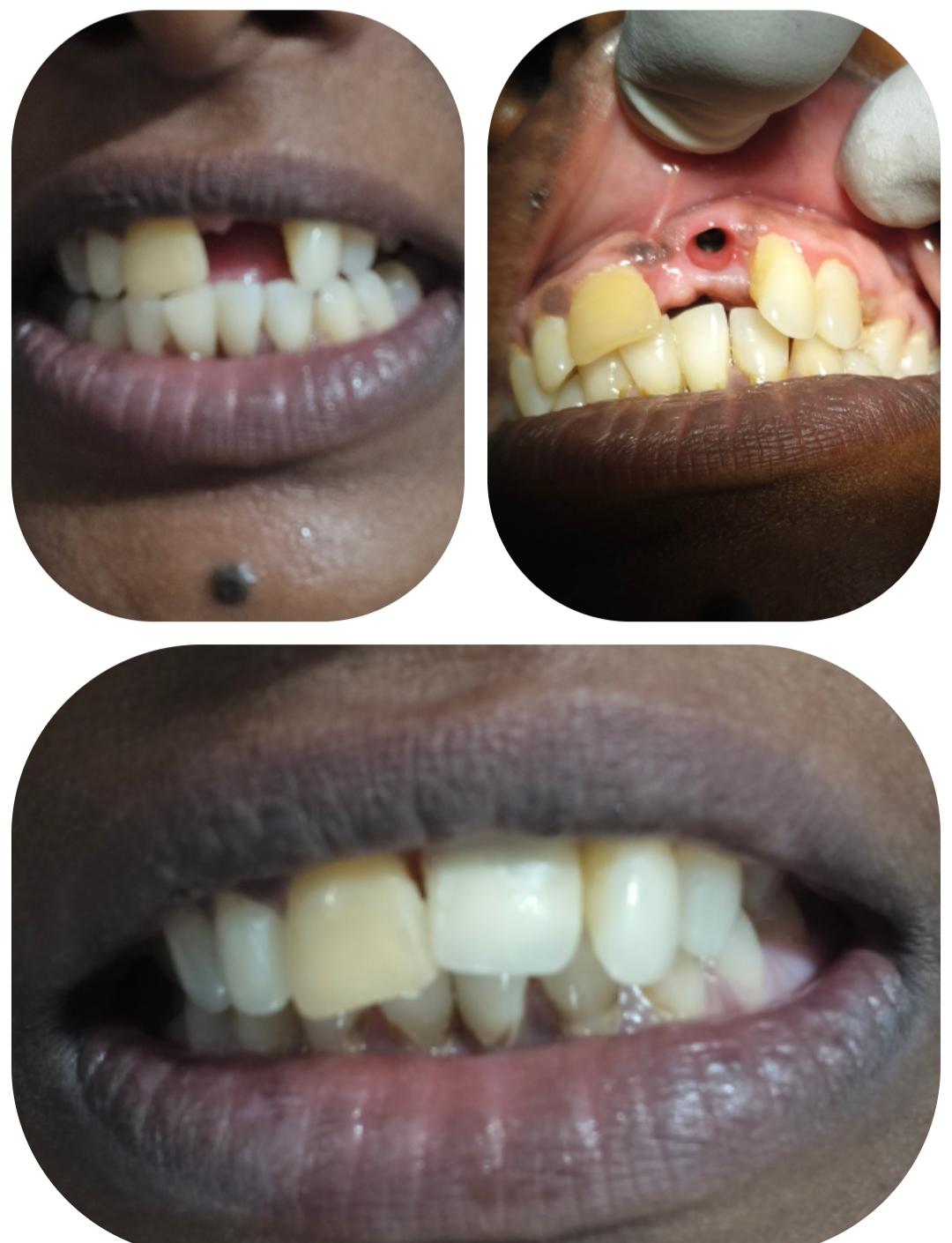Dental transformation case 8